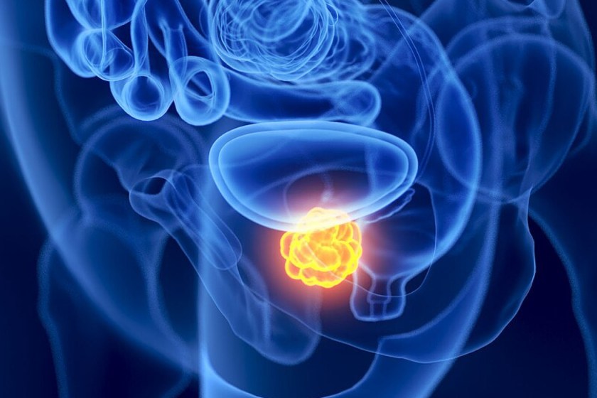 Un proyecto liderado por Sandra Blanco en el Centro de Investigación del Cáncer de Salamanca estudia la epitranscriptómica para mejorar la respuesta al tratamiento del cáncer de próstata.
