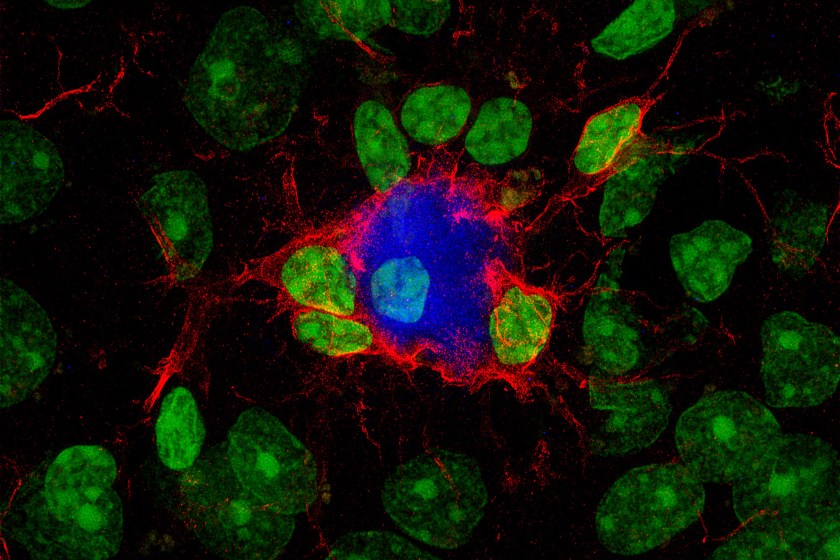 alzhéimer, Alzheimer, CSIC, Instituto de Neurociencias, Universidad Miguel Hernández, UMH, microglía, OLE, PM20D1, beta-amiloide, Cell Death and Disease, José Vicente Sánchez Mut, Victoria Pozzi, EPFL, modelos animales, neurodegeneración, memoria, placas beta-amiloide, investigación biomédica, patentes europeas, neurociencia