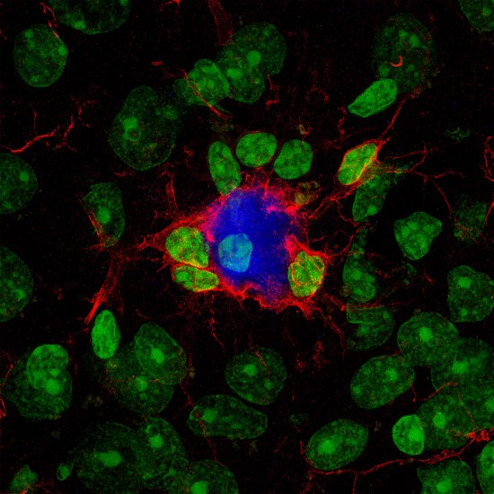 alzhéimer, Alzheimer, CSIC, Instituto de Neurociencias, Universidad Miguel Hernández, UMH, microglía, OLE, PM20D1, beta-amiloide, Cell Death and Disease, José Vicente Sánchez Mut, Victoria Pozzi, EPFL, modelos animales, neurodegeneración, memoria, placas beta-amiloide, investigación biomédica, patentes europeas, neurociencia
