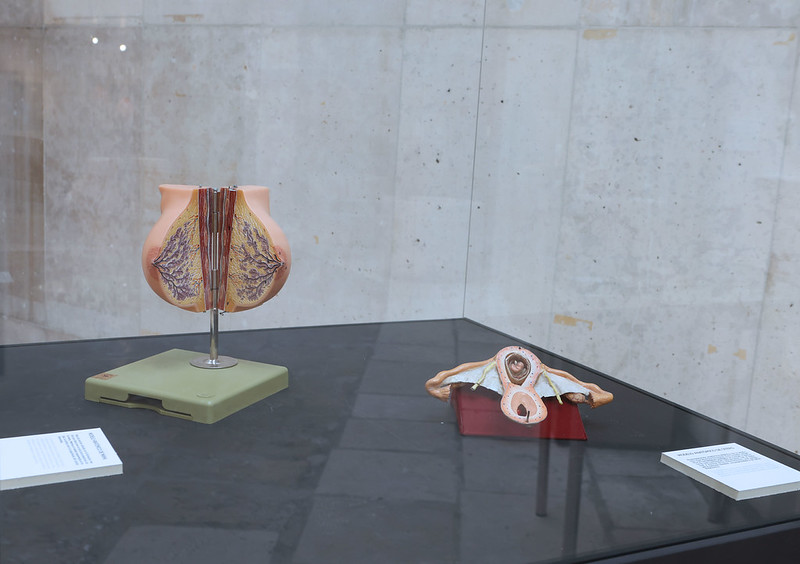 El MUVa inaugura el tercer acto de «Cabeza: Sentidos y Sentimientos», que reúne arte de pacientes y piezas del Museo Anatómico.