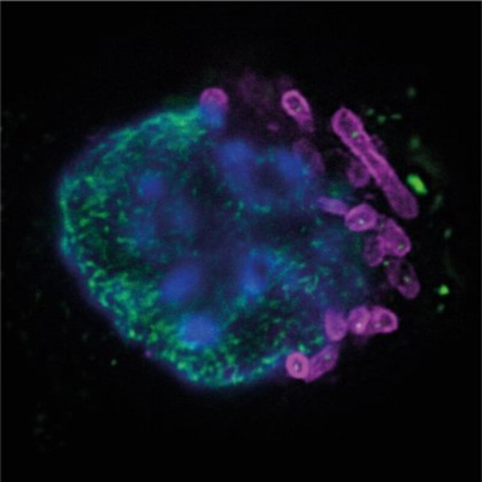 envejecimiento, inflamación envejecimiento, CSIC envejecimiento, linfocitos T, médula ósea, células T CD4 citotóxicas, hematopoyesis, neutrófilos, CCL5, CCR5, maraviroc, inmunosenescencia, Nature Aging, María Mittelbrunn, Enrique Gabandé-Rodríguez, Centro de Biología Molecular Severo Ochoa