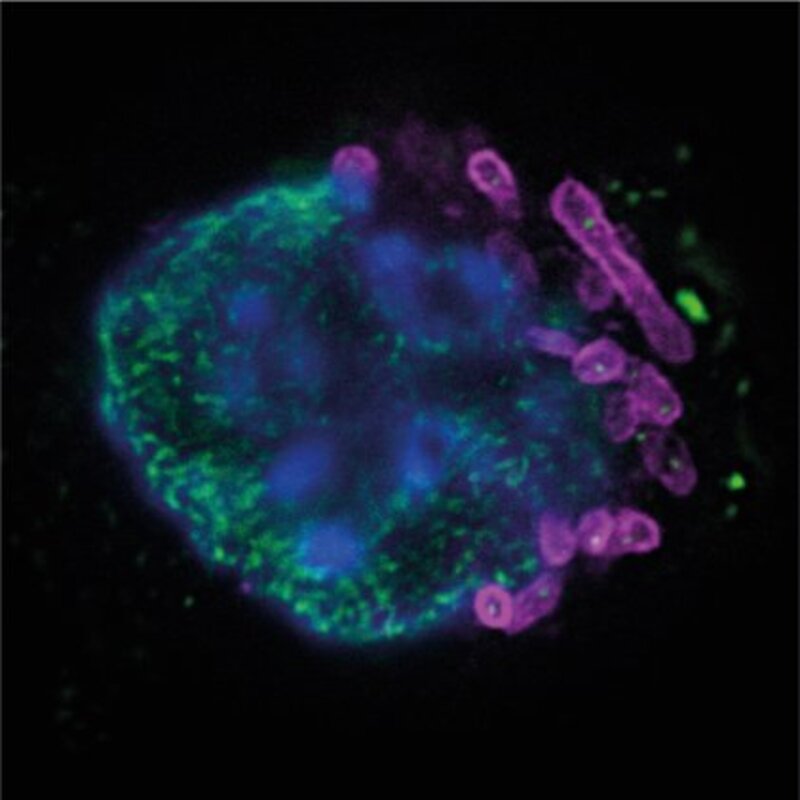 envejecimiento, inflamación envejecimiento, CSIC envejecimiento, linfocitos T, médula ósea, células T CD4 citotóxicas, hematopoyesis, neutrófilos, CCL5, CCR5, maraviroc, inmunosenescencia, Nature Aging, María Mittelbrunn, Enrique Gabandé-Rodríguez, Centro de Biología Molecular Severo Ochoa