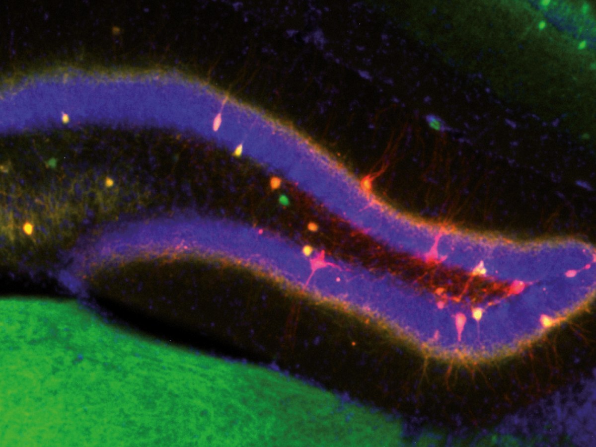 El CSIC descubre cómo el cerebro decide entre actualizar un recuerdo o conservarlo