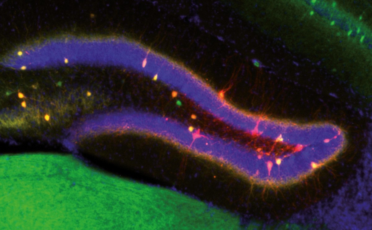 El CSIC descubre cómo el cerebro decide entre actualizar un recuerdo o conservarlo